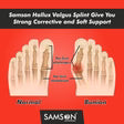 Samson Hallux Valgus Splint