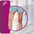 دعامات الرضفة المفتوحة للركبة